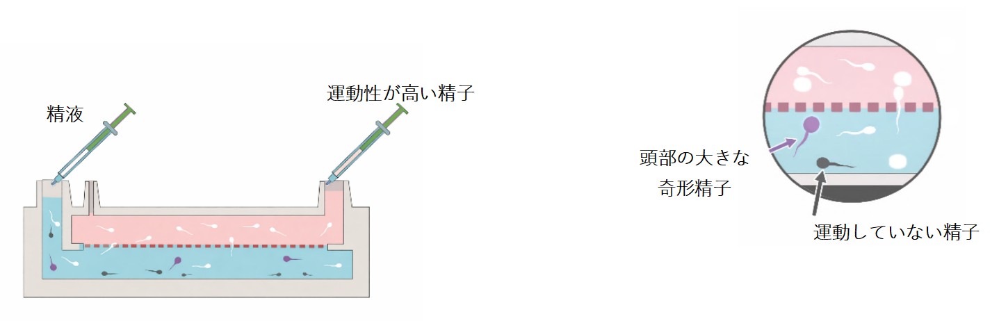 膜構造を用いた生理学的精子選択術