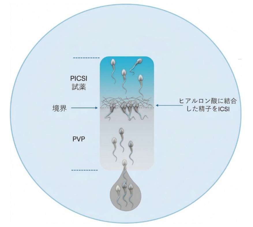 PICSI（ヒアルロンを用いた生理学的精子選別法）